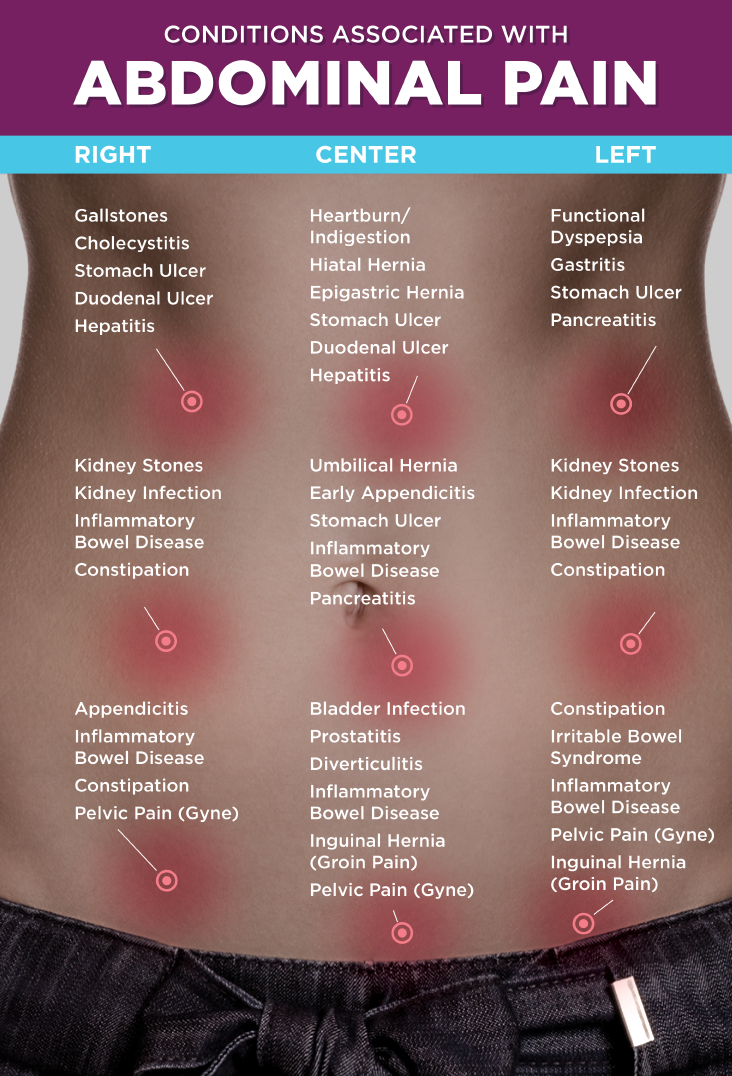 ibs symptoms