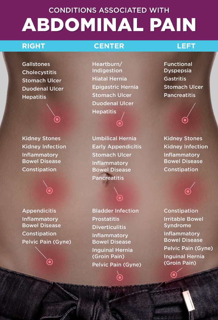 Irritable Bowel Syndrome IBS My Remedy Natural Medicine